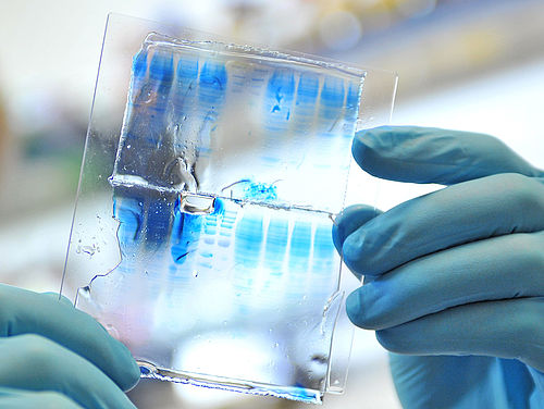 Gel electrophoresis, in which proteins can be separated with the help of polyacrylamide gel